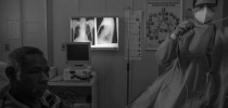 tuberculose
