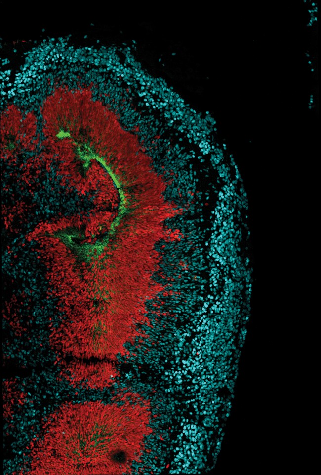 Zika nos minicérebros: receptor AXL (verde), possível chave para o vírus penetrar nas células precursoras (vermelho) do tecido cerebral