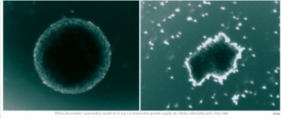 Efeito devastador: neuroesfera saudável (à esq.) e neuroesfera gerada a partir de células infectadas pelo vírus zika( © PATRICIA GARCEZ / UFRJ E IDOR)